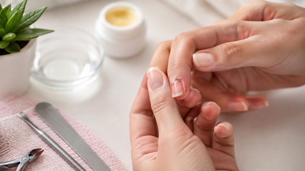unhas quebradas