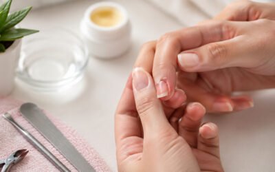unhas quebradas