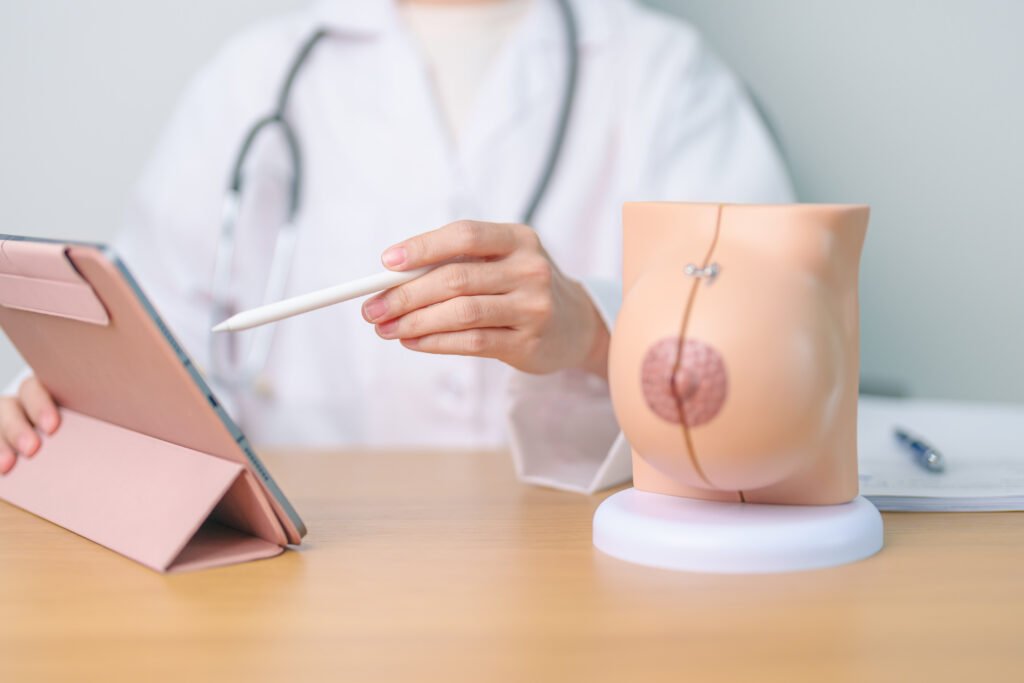 residência médica em Mastologia