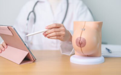 residência médica em Mastologia