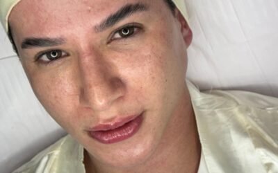 limpeza de pele