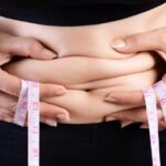 cirurgia plástica pós-bariátrica