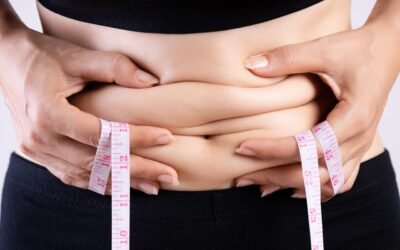 cirurgia plástica pós-bariátrica
